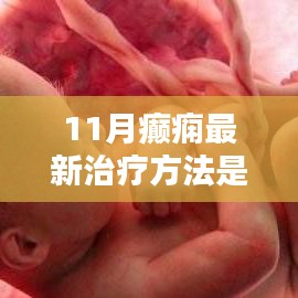 揭秘革命性科技突破，最新癲癇治療技術(shù)，為癲癇患者帶來福音