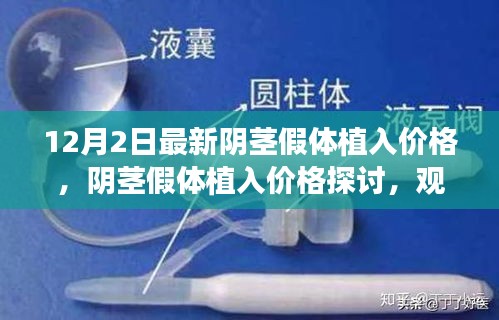 最新陰莖假體植入價(jià)格解析與觀點(diǎn)探討，全面闡述與深度解析