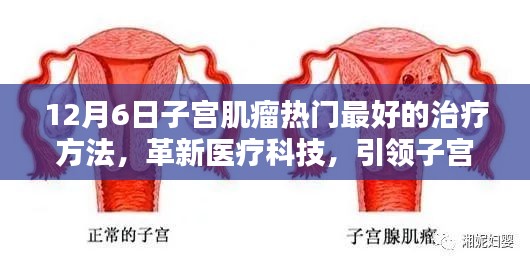 12月6日子宮肌瘤熱門最好的治療方法，革新醫(yī)療科技，引領子宮肌瘤治療新時代——智能微創(chuàng)消融系統(tǒng)