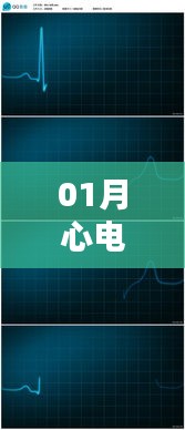 心電圖素材一月熱門精選