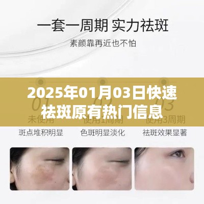 『最新熱門信息』2025年快速祛斑新方法揭秘