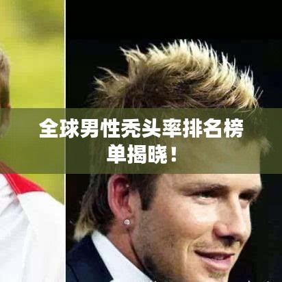 全球男性禿頭率排名榜單揭曉！