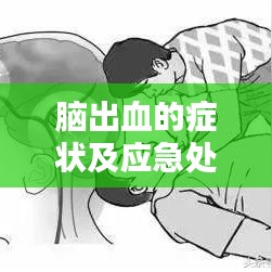 腦出血的癥狀及應(yīng)急處理，百度來揭秘！