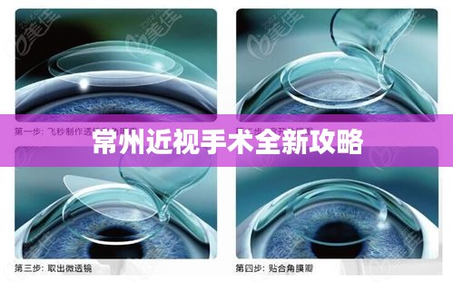 常州近視手術(shù)全新攻略