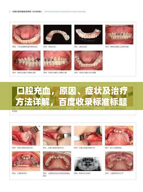口腔充血，原因、癥狀及治療方法詳解，百度收錄標準標題