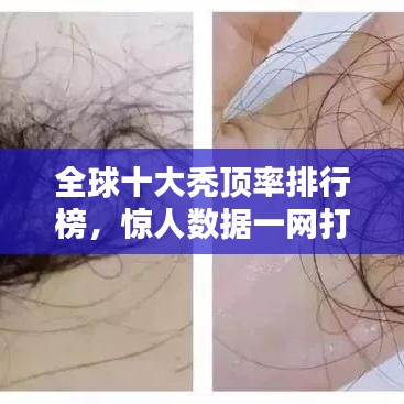 全球十大禿頂率排行榜，驚人數(shù)據(jù)一網(wǎng)打盡！