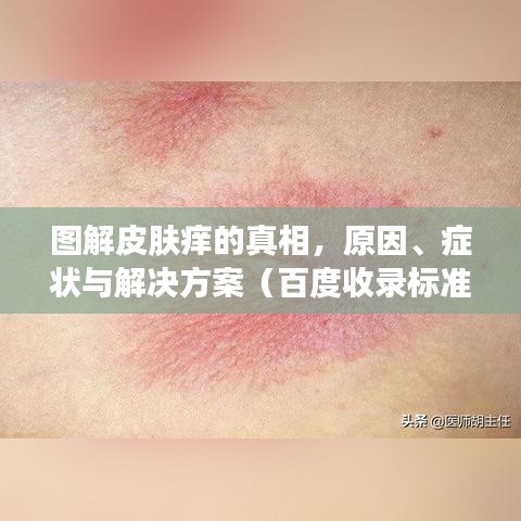 圖解皮膚癢的真相，原因、癥狀與解決方案（百度收錄標(biāo)準(zhǔn)）